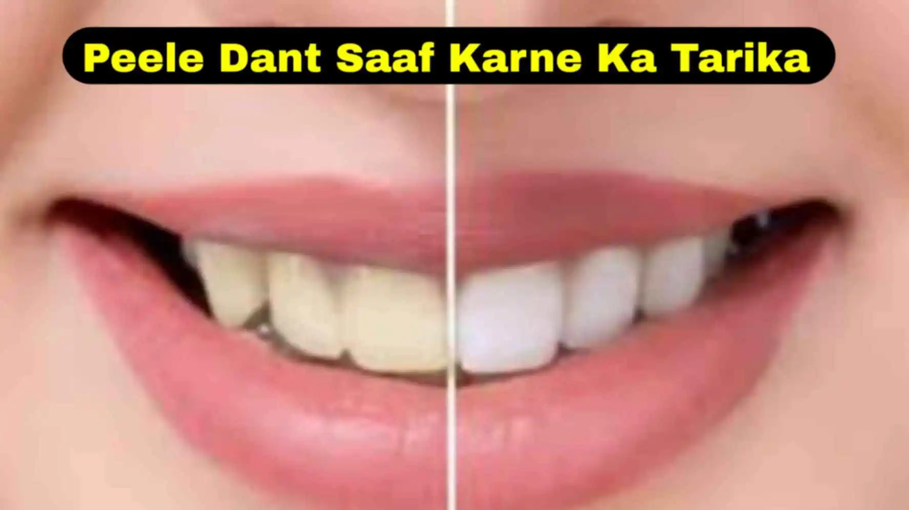 Peele dant saaf karne ka tarika